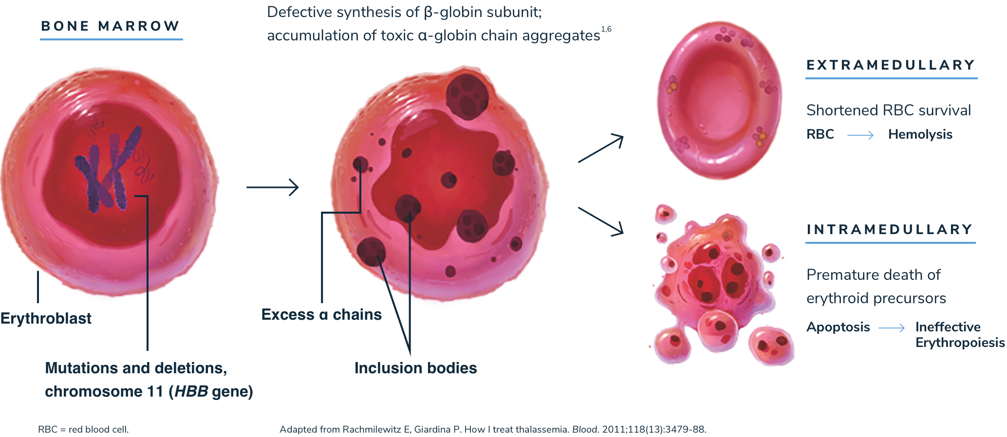 Beta-Thalassemia Prevalence, Pathophysiology And Inheritance